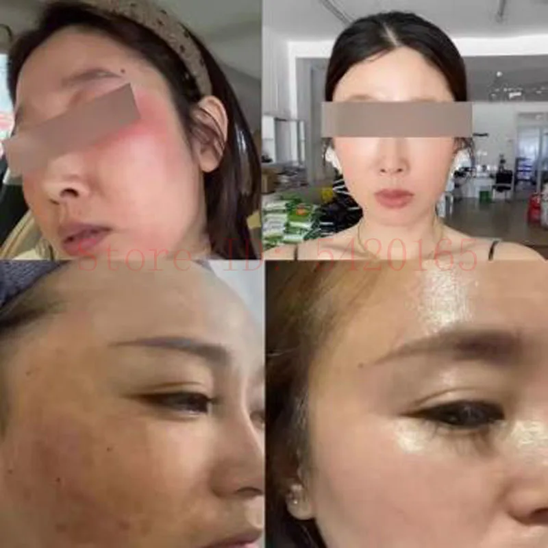 GHK-Cu Blue Copper Peptide 80000U Freeze-Dried Powder Essence Remove Wrinkles And Fine Lines Elasticity Rejuvenating Combination