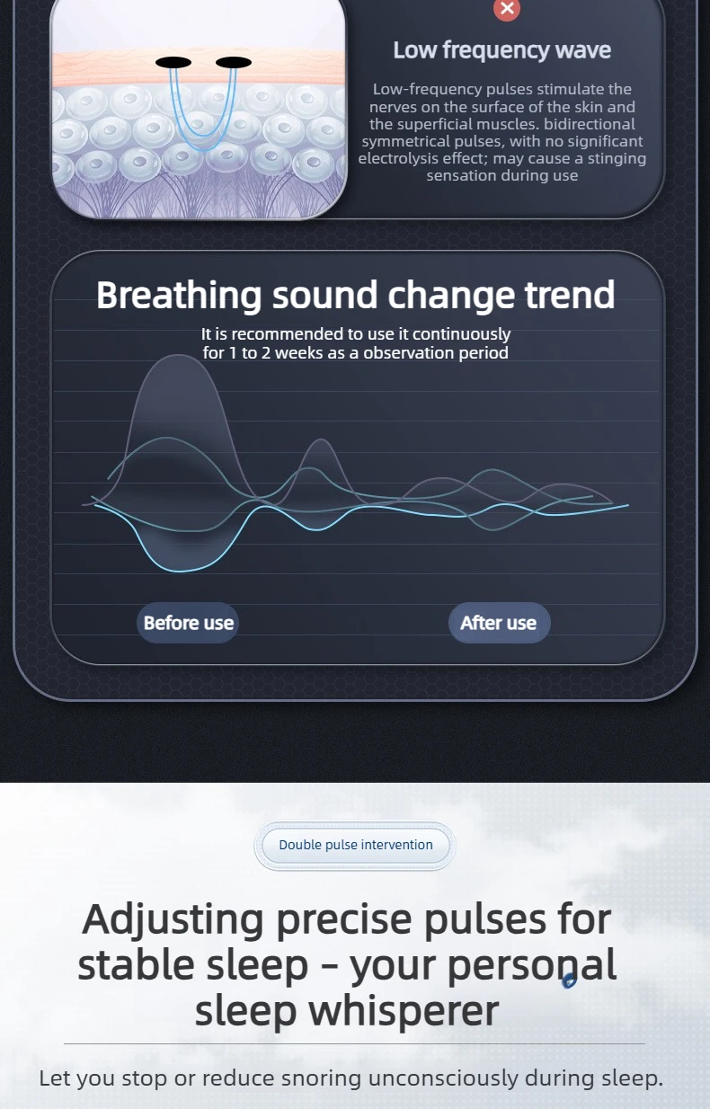 2026 New Anti-Snore Device with Dual-Pulse Stimulation - Sleep Apnea Relief, Snore Reduction, Muscle Trainer for Silent Night