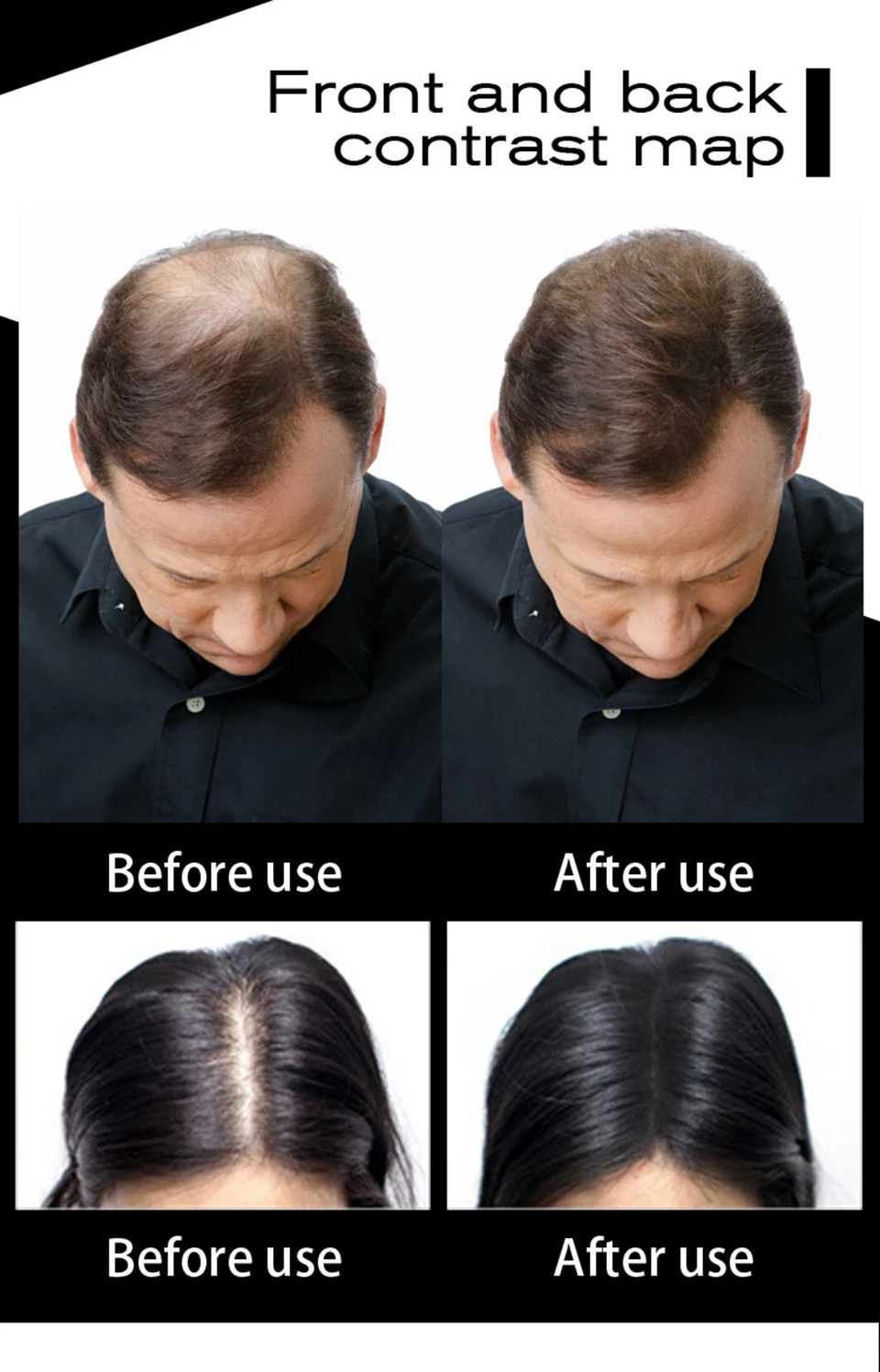 SEVICH Hair Fiber 100g Keratin Hair Fiber Thickening Powder Hair Building Fiber Spray Instant Regrowth Powder Hair Loss Conceale