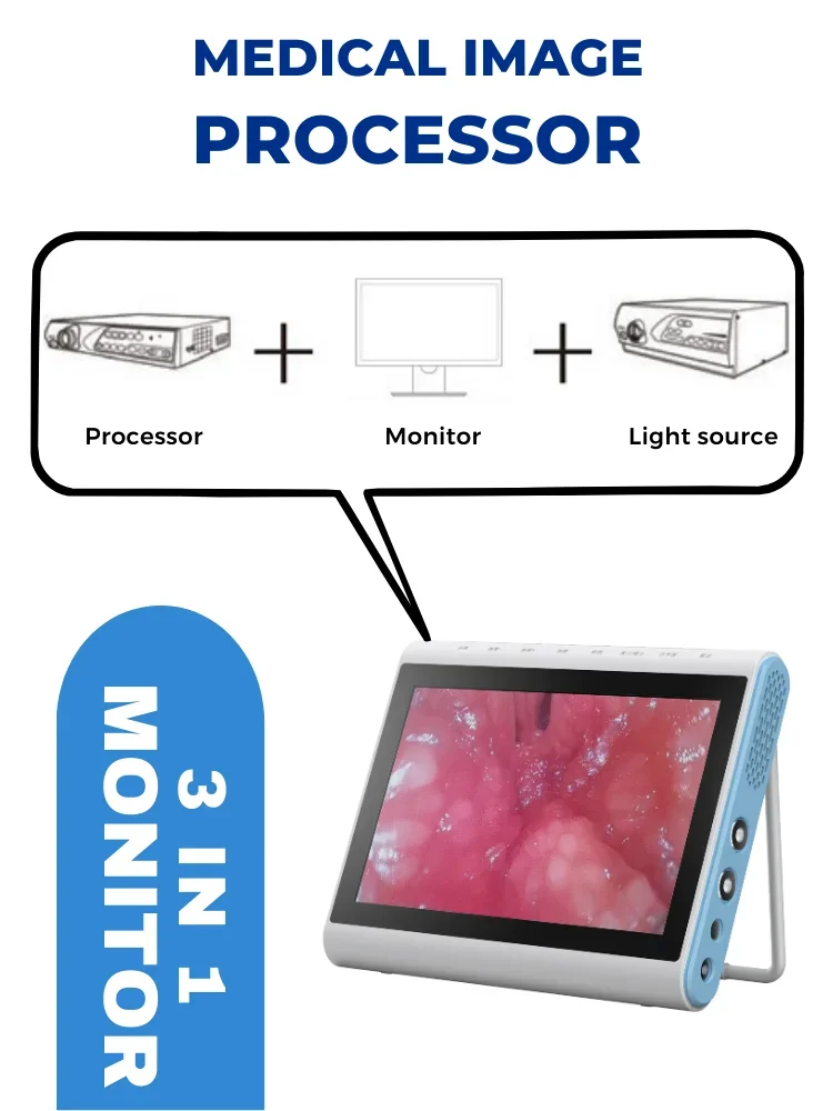 2026 Nasopharyngoscope China BESDATA 3.5mm/2.8mm USB Rhinolaryngoscope Portable Flexible Endoscopy For Examination Diagnose