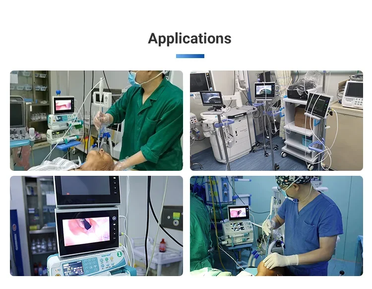 2026 Nasopharyngoscope China BESDATA 3.5mm/2.8mm USB Rhinolaryngoscope Portable Flexible Endoscopy For Examination Diagnose