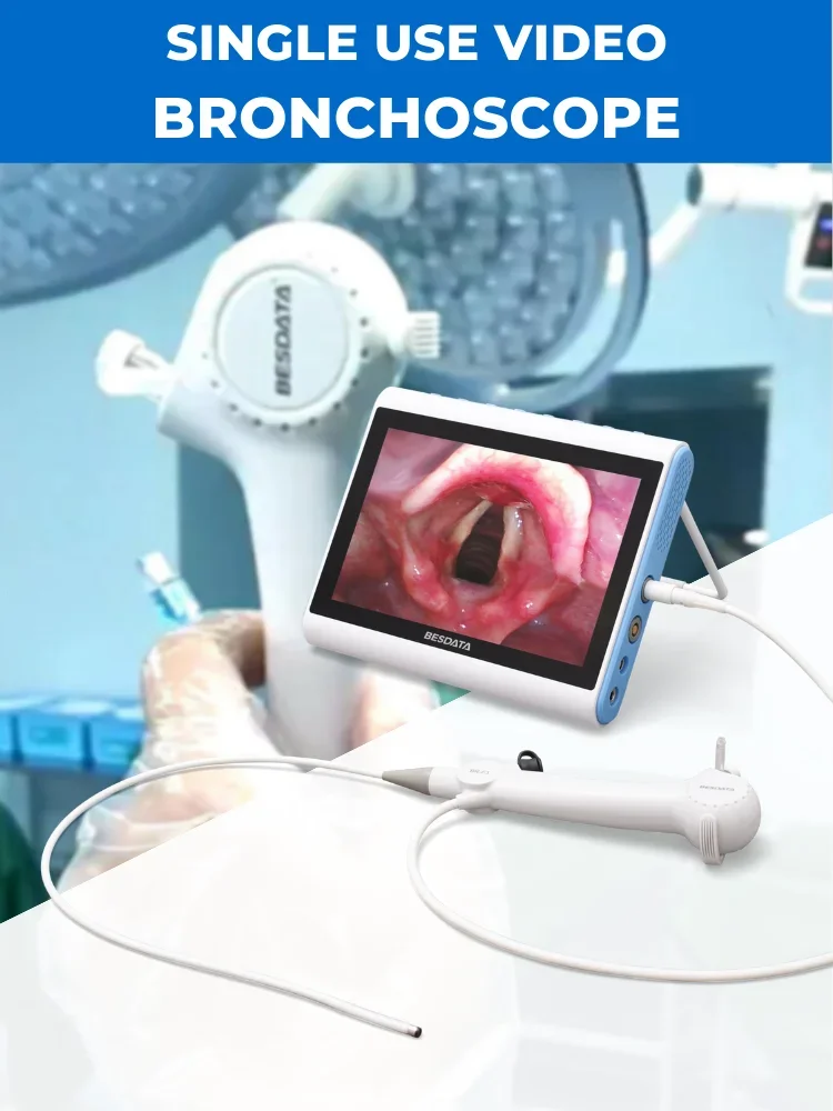 2026 Nasopharyngoscope China BESDATA 3.5mm/2.8mm USB Rhinolaryngoscope Portable Flexible Endoscopy For Examination Diagnose