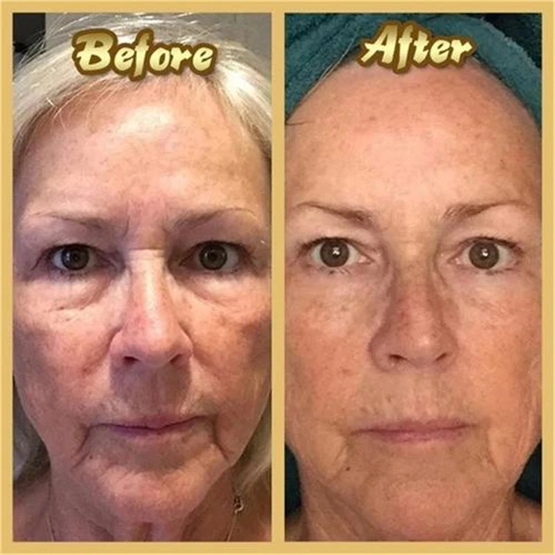 Hydrolyzed Collagen Capsules,Hyaluronic Acid, Biotin,Vitamins,Supports Healthy Skin Joints Hair Nails,NAD+ Supplement for Women