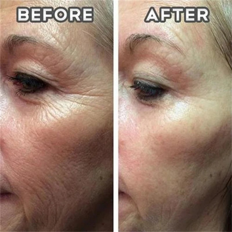Hydrolyzed Collagen Capsules,Hyaluronic Acid, Biotin,Vitamins,Supports Healthy Skin Joints Hair Nails,NAD+ Supplement for Women
