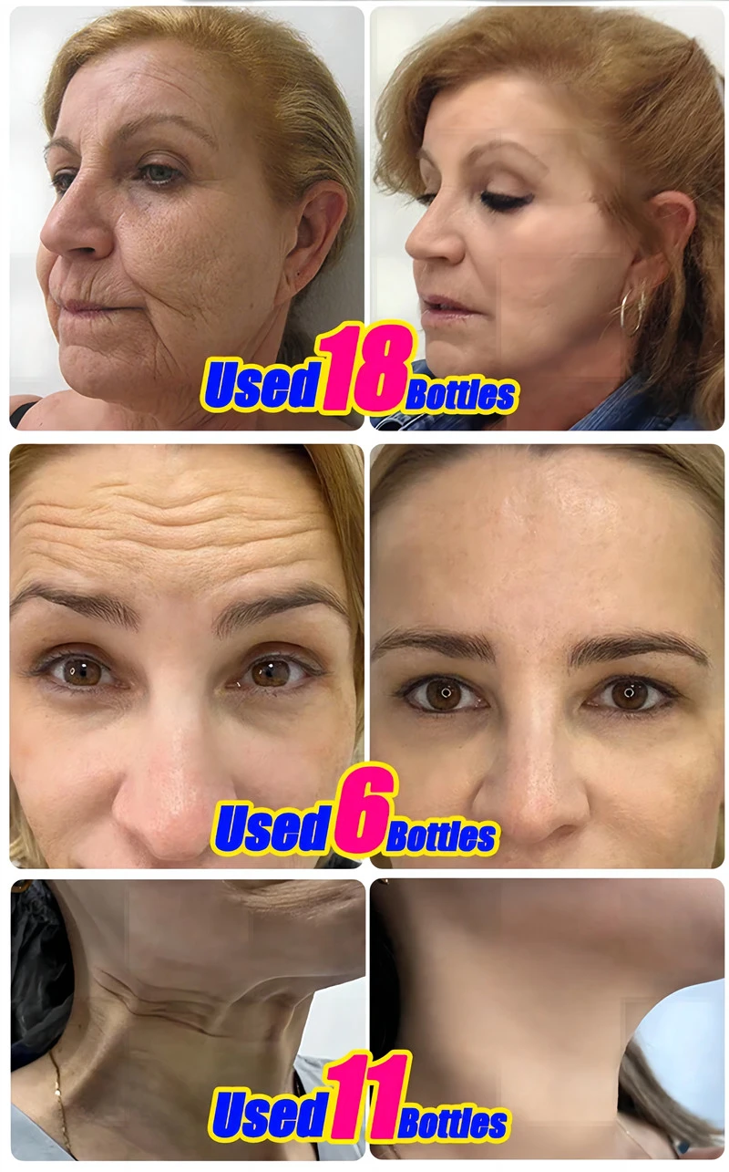 Hydrolyzed Collagen Capsules,Hyaluronic Acid, Biotin,Vitamins,Supports Healthy Skin Joints Hair Nails,NAD+ Supplement for Women