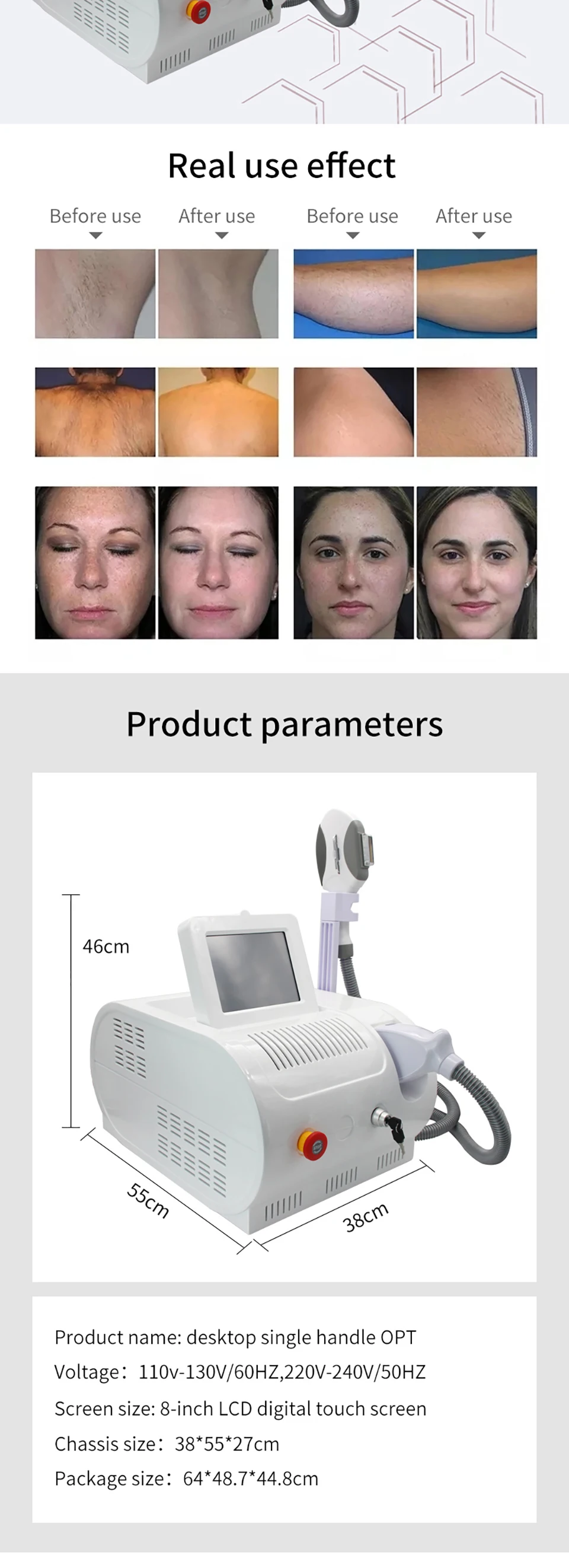 500,000 Shoots OPT Painless IPL Ice E Light 8 Filters Anti-Aging Cooling System Photonic Rejuvenation Hair Removal Machine Salon