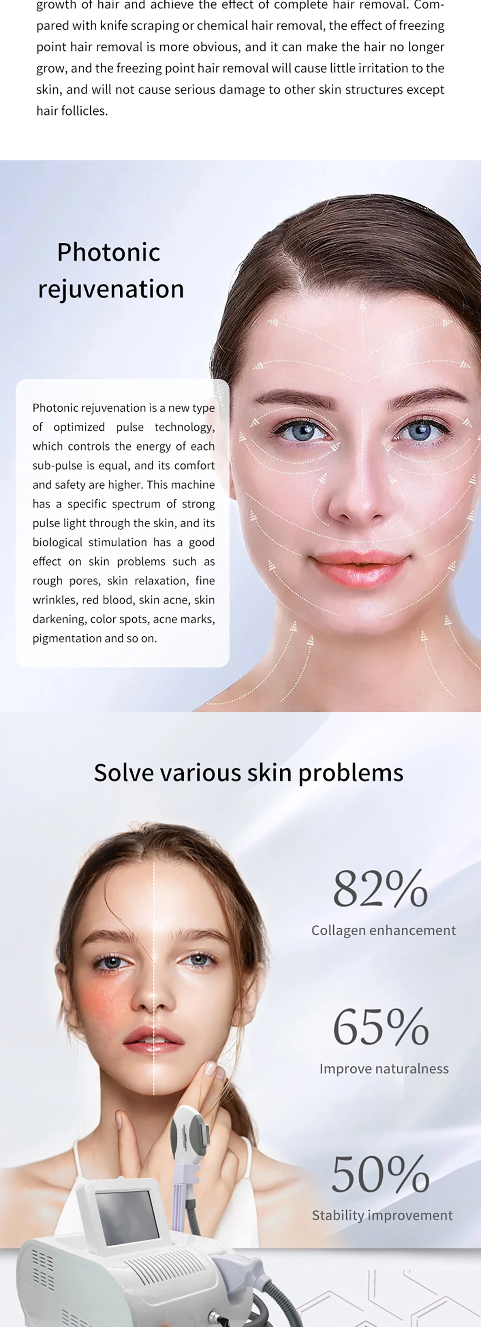 500,000 Shoots OPT Painless IPL Ice E Light 8 Filters Anti-Aging Cooling System Photonic Rejuvenation Hair Removal Machine Salon