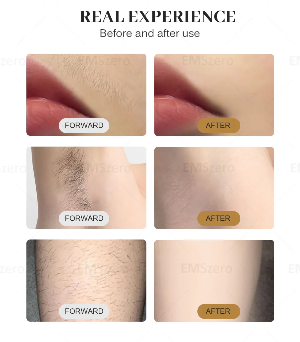 Portable 808 3wave Diode Permanent Hair Remove Fast Depilation Painfree Follicle Penetration Skin Rejuvenation Device