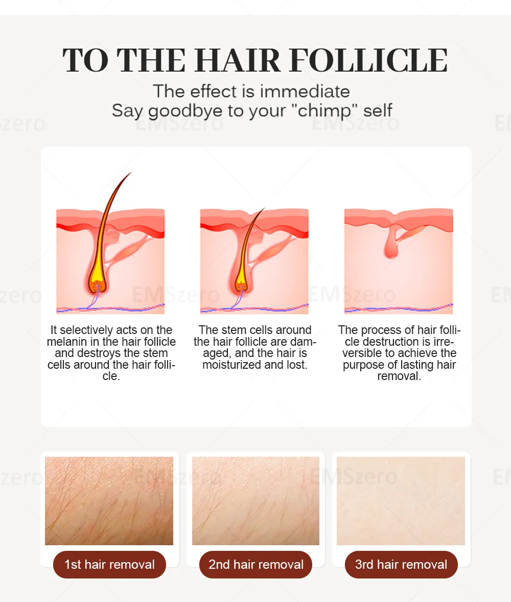 Portable 808 3wave Diode Permanent Hair Remove Fast Depilation Painfree Follicle Penetration Skin Rejuvenation Device