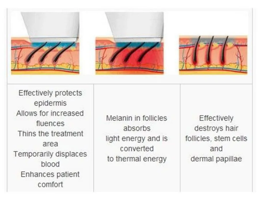 Portable 808 3wave Diode Permanent Hair Remove Fast Depilation Painfree Follicle Penetration Skin Rejuvenation Device