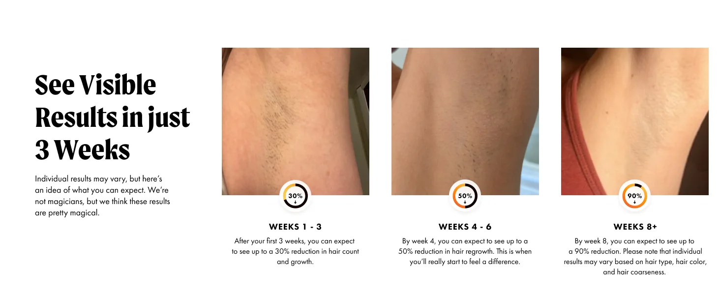IPL Hair Removal with Ice Cooling Care Function for Women Men Permanent,Unlimited Flashes Painless Epilator IPL Hair Remover
