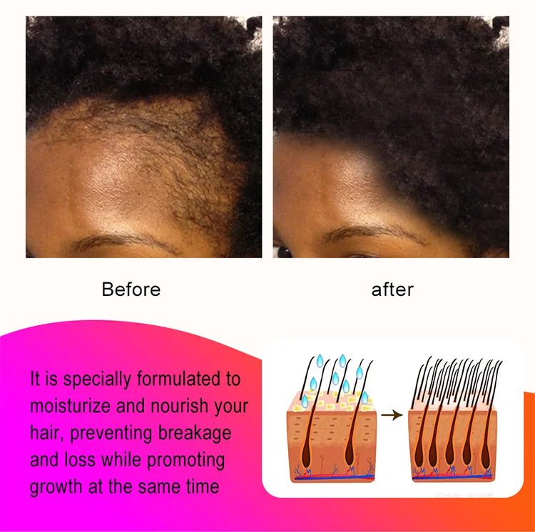 Sevich 100g Africa Traction Alopecia Chebe Hair Butter Moisturize & Protect Natural Hair Strong Hair Root Hair Loss Treatment