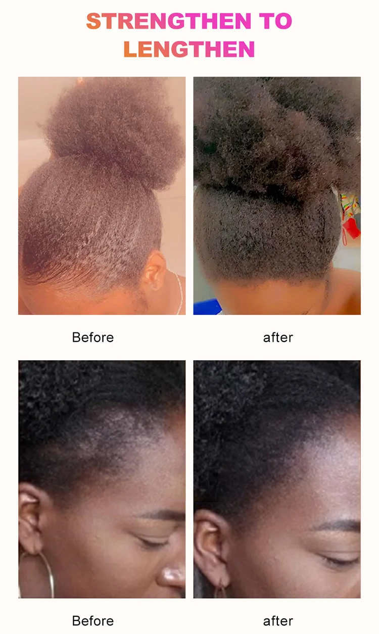 Sevich 100g Africa Traction Alopecia Chebe Hair Butter Moisturize & Protect Natural Hair Strong Hair Root Hair Loss Treatment