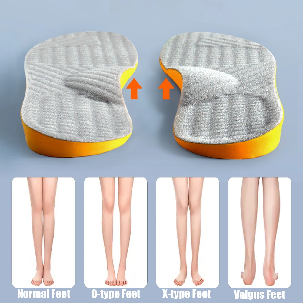 Flat Foot Orthopedic Insoles for Men Women Shoes Arch Support Insoles for Children X/O Type Legs Knee Varus Correction Shoe Pads