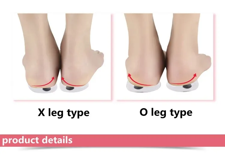 Orthopedic Gel Insoles Magnet Massage Foot Care Silicone O/X Leg Type Valgus Varus Correction for Plantar Fasciitis Shoe Inserts