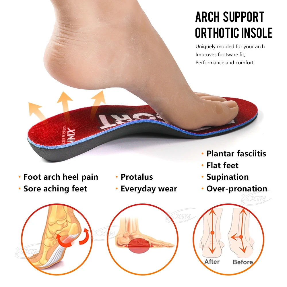 【Xxin】Arch Support Insoles Flat Foot Shoe Insoles Orthopedic Shoe Pad Women Men Sport Insole Size35-46