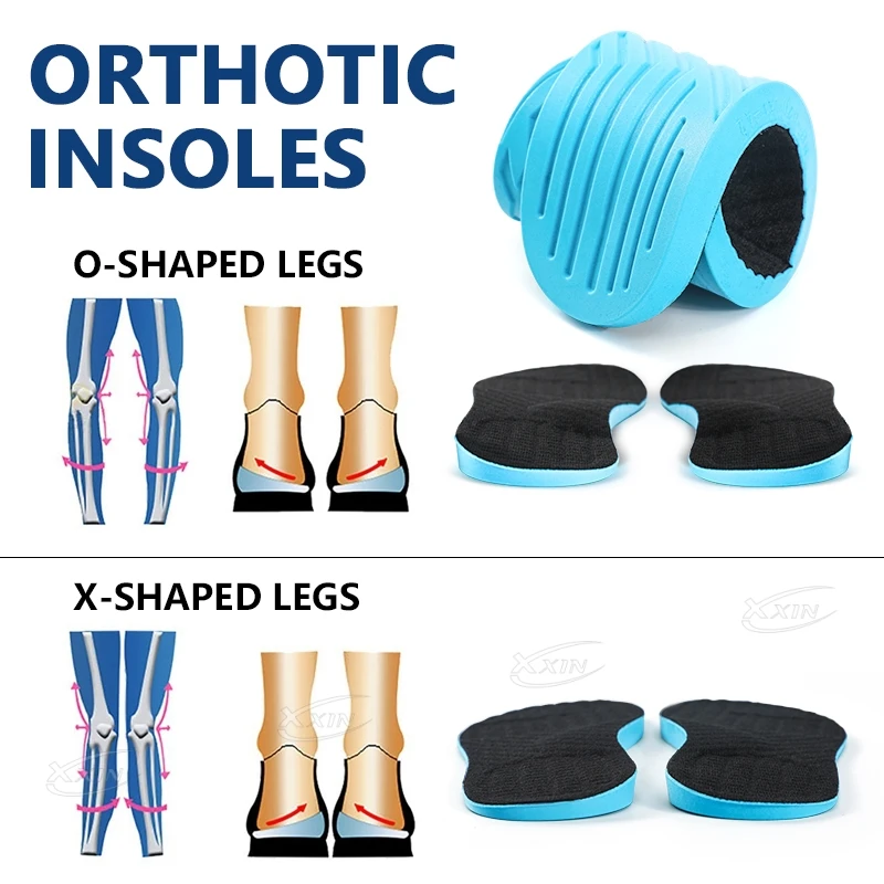 【Xxin】Men Women X Leg Correction Insoles Orthopedic Shoe Pads O Leg Insole Flat Arch Shoe Inserts Size35-46