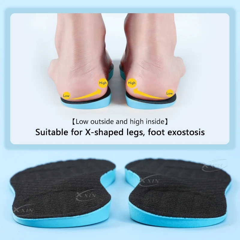【Xxin】Men Women X Leg Correction Insoles Orthopedic Shoe Pads O Leg Insole Flat Arch Shoe Inserts Size35-46