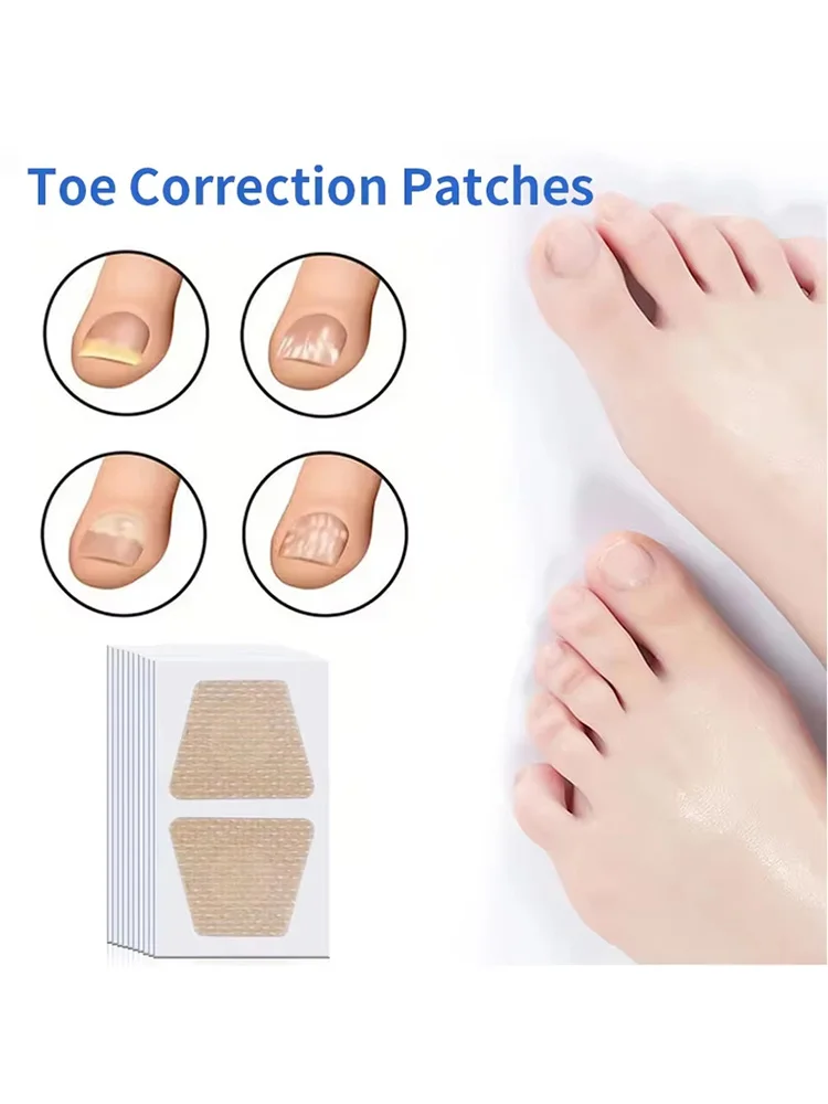 Toenail Fungus Patch Nail Repair Patches Nail Ingrown Correction Stickers for Discolored or Damaged Nails Sticker Toenail Care