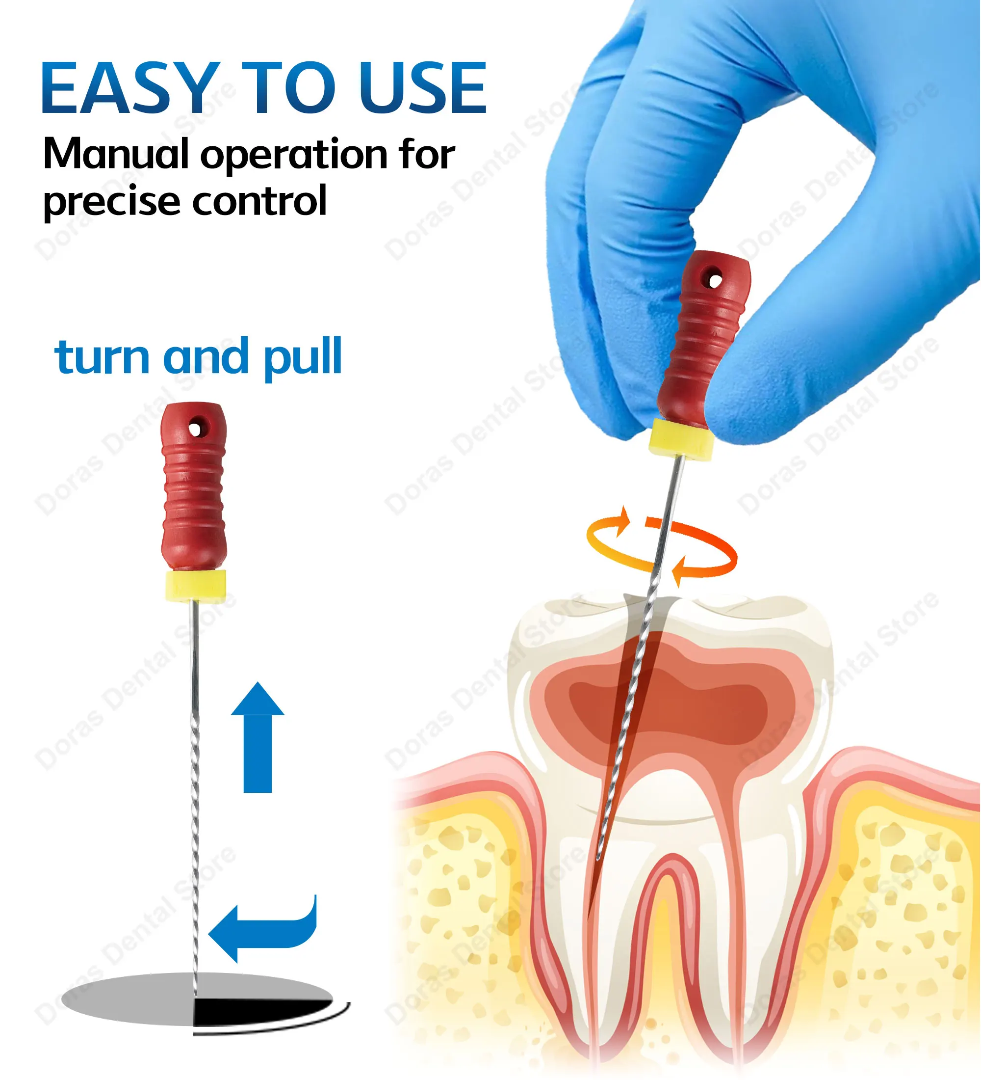 Glin NITI Reamer handuse Endodontic File Dental Instrument for Root Canal Treatment and Canal Preparation Endodontics