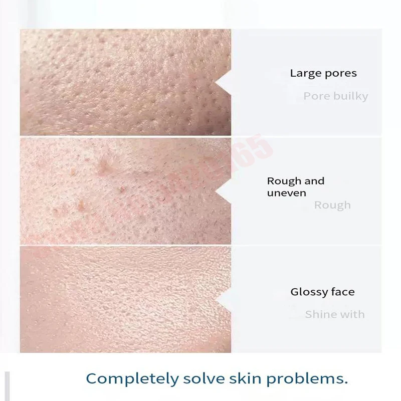 Exfoliating Fluid PS1 PS2 PS3 PSC Moisturizing Essence Small Bubble Scrub Deep Cleaning Cutin Moisturizing Beauty Lotion