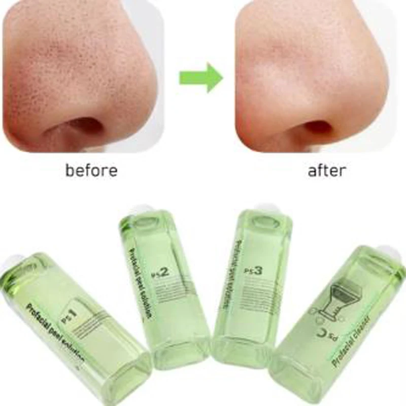 Exfoliating Fluid PS1 PS2 PS3 PSC Moisturizing Essence Small Bubble Scrub Deep Cleaning Cutin Moisturizing Beauty Lotion