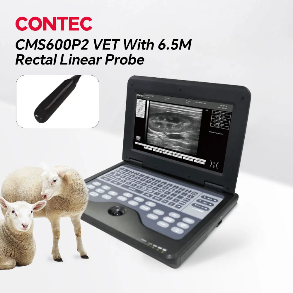 Contec Veterinary Ultrasound Scanner Laptop for Horse Equine Cow Sheep Dog Cat - Multiple Probe Types