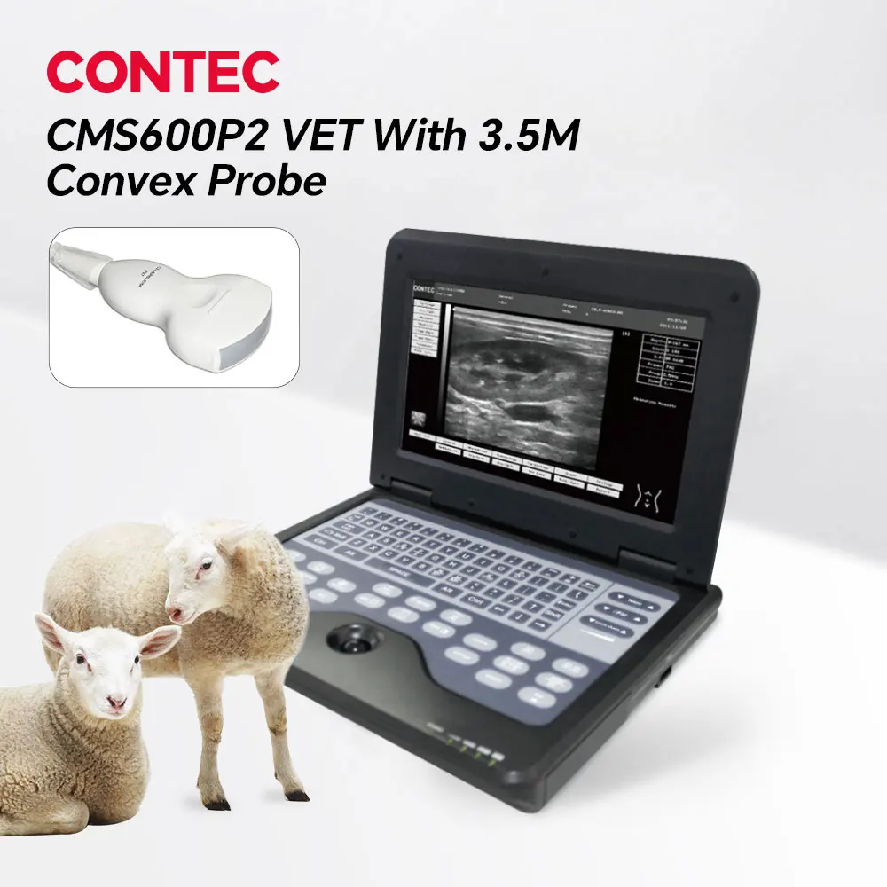 Contec Veterinary Ultrasound Scanner Laptop for Horse Equine Cow Sheep Dog Cat - Multiple Probe Types