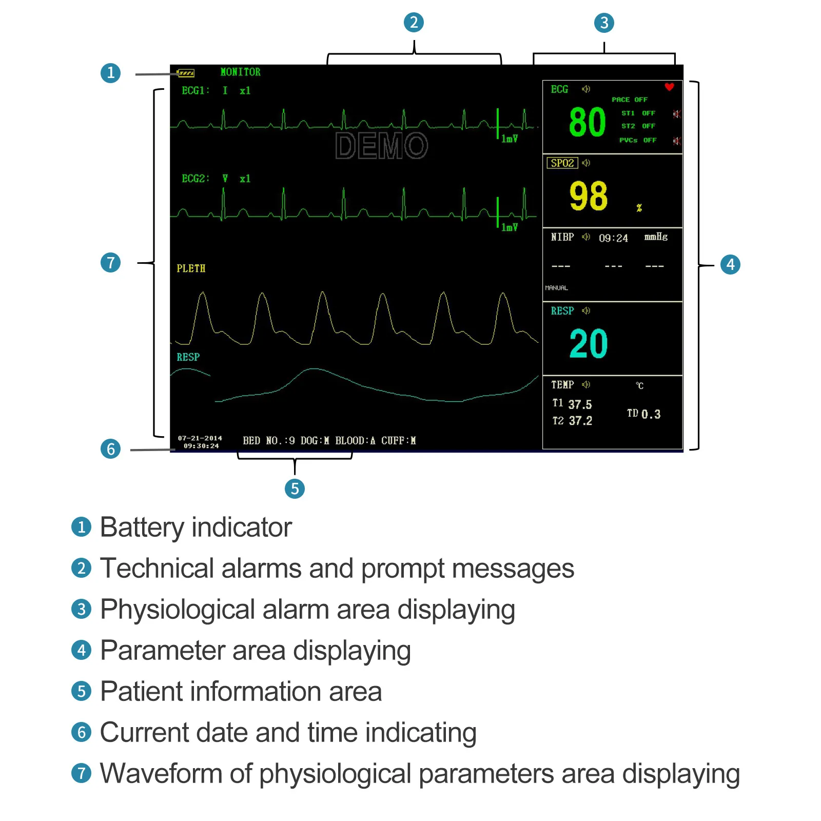 CONTEC Portable Patient Monitor Human/Veterinary 8" Vital Sign Monitor ECG NIBP RESP SPO2 PR TEMP (Printer&Etco2 Option)