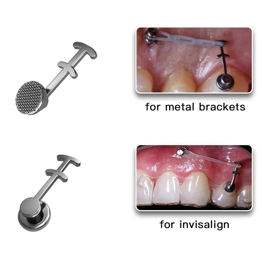 50Pcs Dental Orthodontic Lingual Buttons Crimpable Hook Metal Composite Bondable Traction Hook Clear Ceramic Hook On Arch Wire