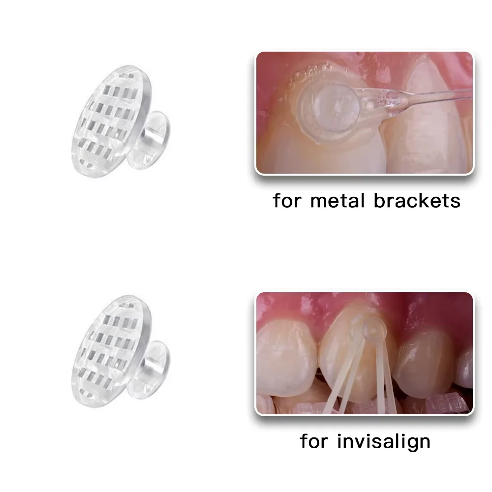 50Pcs Dental Orthodontic Lingual Buttons Crimpable Hook Metal Composite Bondable Traction Hook Clear Ceramic Hook On Arch Wire