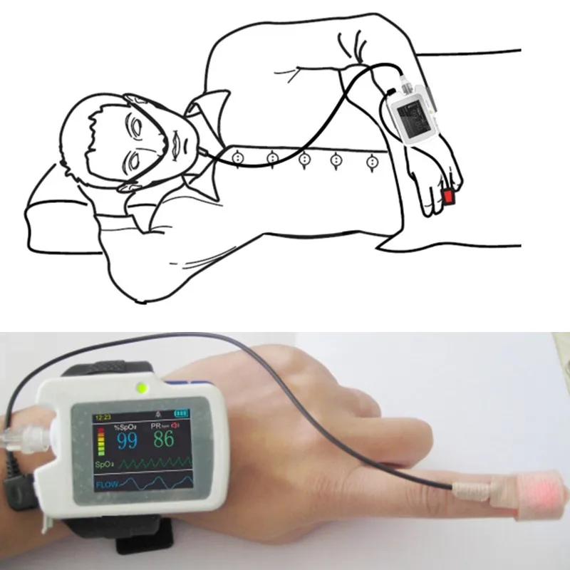 CONTEC Sleep Apnea Screening Monitor RS01/RS10 - Snoring Syndrome Home Care Device for Sleep Apnea Monitoring