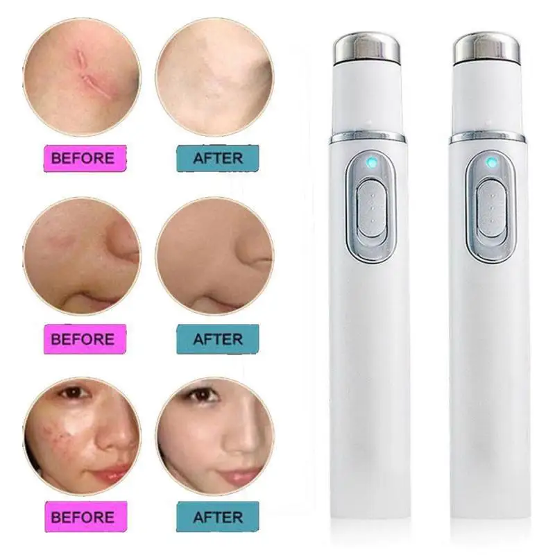 Facial Beauty Device Eye Massager Blue Light Black Eye Circles Facial Care Tool Lightening Texture Maintaining Eye Bags Health