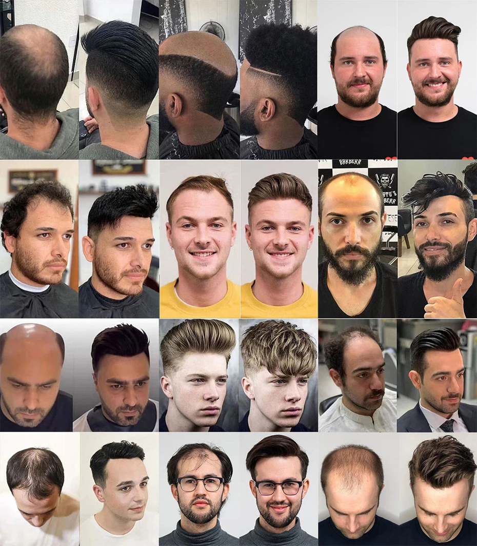 0.03mm Ultra-Thin Skin Invisible Wig Male Natural Hairline Men Capillary Prosthesis Men Toupee Human Hair System Unit Hairpiece