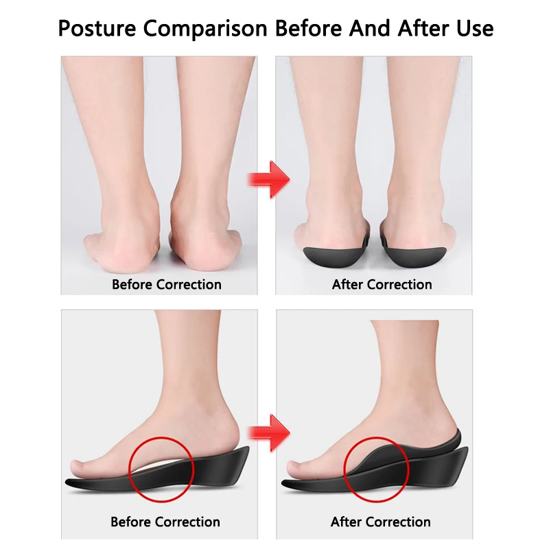 Orthotic Insoles for Plantar Fasciitis Pain Relief Therapy Flat Feet Arch Support Insoles for Shoes Women Men XO-Legs Corrector