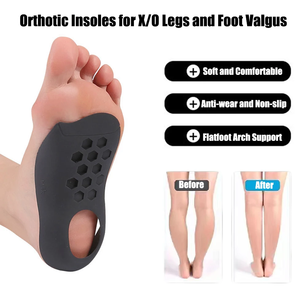 Orthotic Insoles for Plantar Fasciitis Pain Relief Therapy Flat Feet Arch Support Insoles for Shoes Women Men XO-Legs Corrector