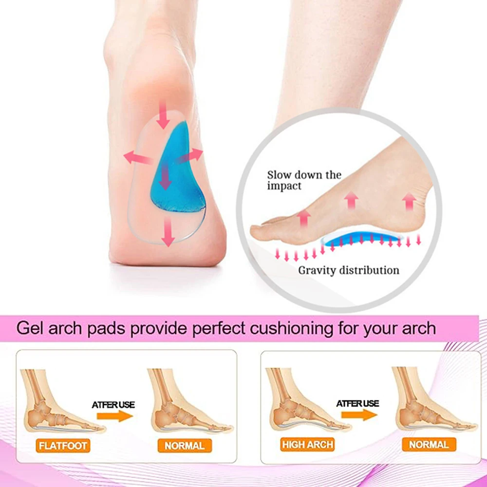 1Pair Arch Orthotic Support Silicone Insoles for Feet O/X Foot Plate Flat Foot Corrector Shoe Cushion Foot Care Insert Insole