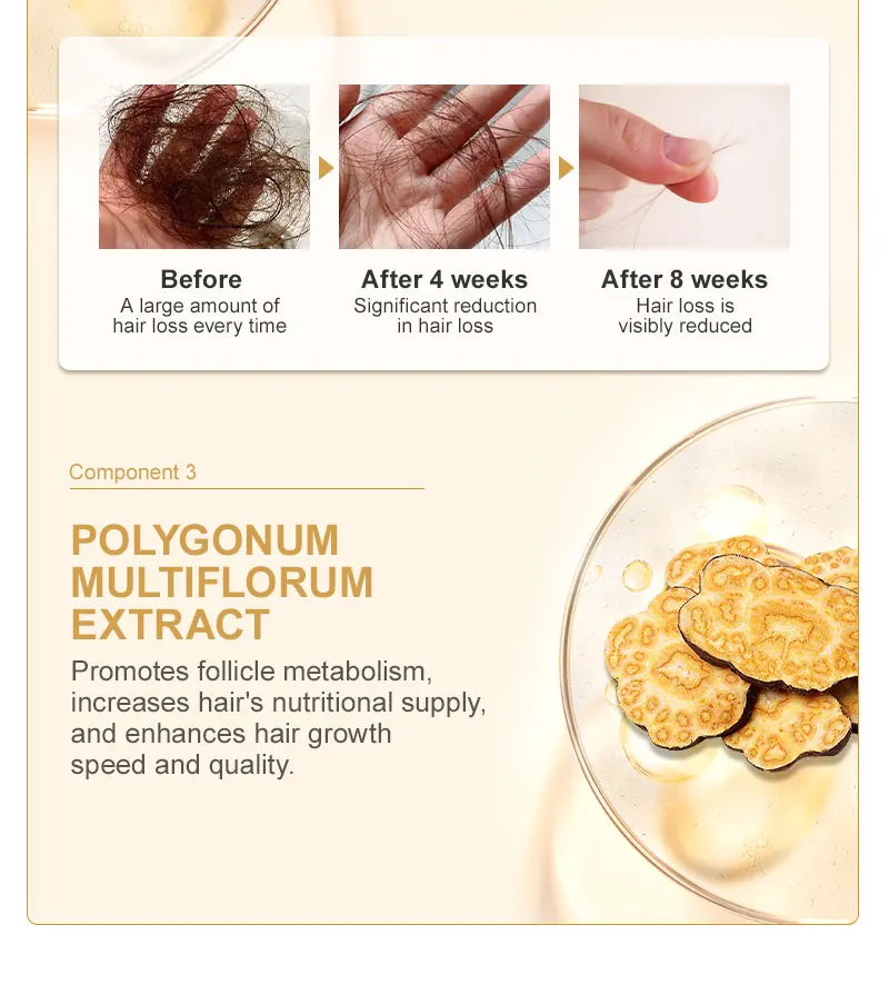 PURC Biotin Hair Growth Oil for Men Women Hair Loss Treatment Fast Grow Hair Spray Regrowth Thicken Oil Hair Care Products