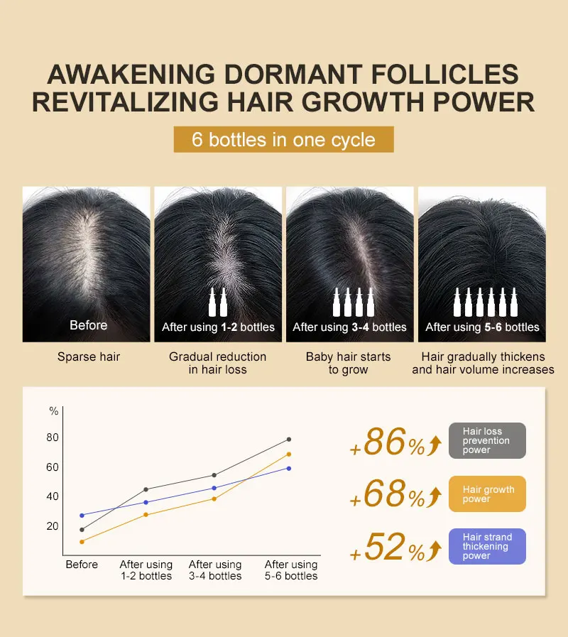 PURC Biotin Hair Growth Oil for Men Women Hair Loss Treatment Fast Grow Hair Spray Regrowth Thicken Oil Hair Care Products