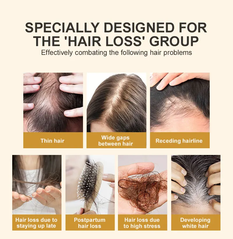 PURC Biotin Hair Growth Oil for Men Women Hair Loss Treatment Fast Grow Hair Spray Regrowth Thicken Oil Hair Care Products