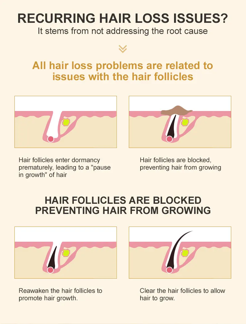 PURC Biotin Hair Growth Oil for Men Women Hair Loss Treatment Fast Grow Hair Spray Regrowth Thicken Oil Hair Care Products