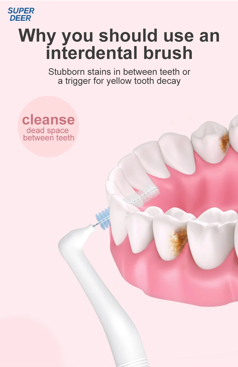 Fawnmum 0.6-1.2mm Interdental Brush For Teeth Cleaning Dentistry Between Teeth Oral Care Toothpick Dental Tool Floss Orthodontic