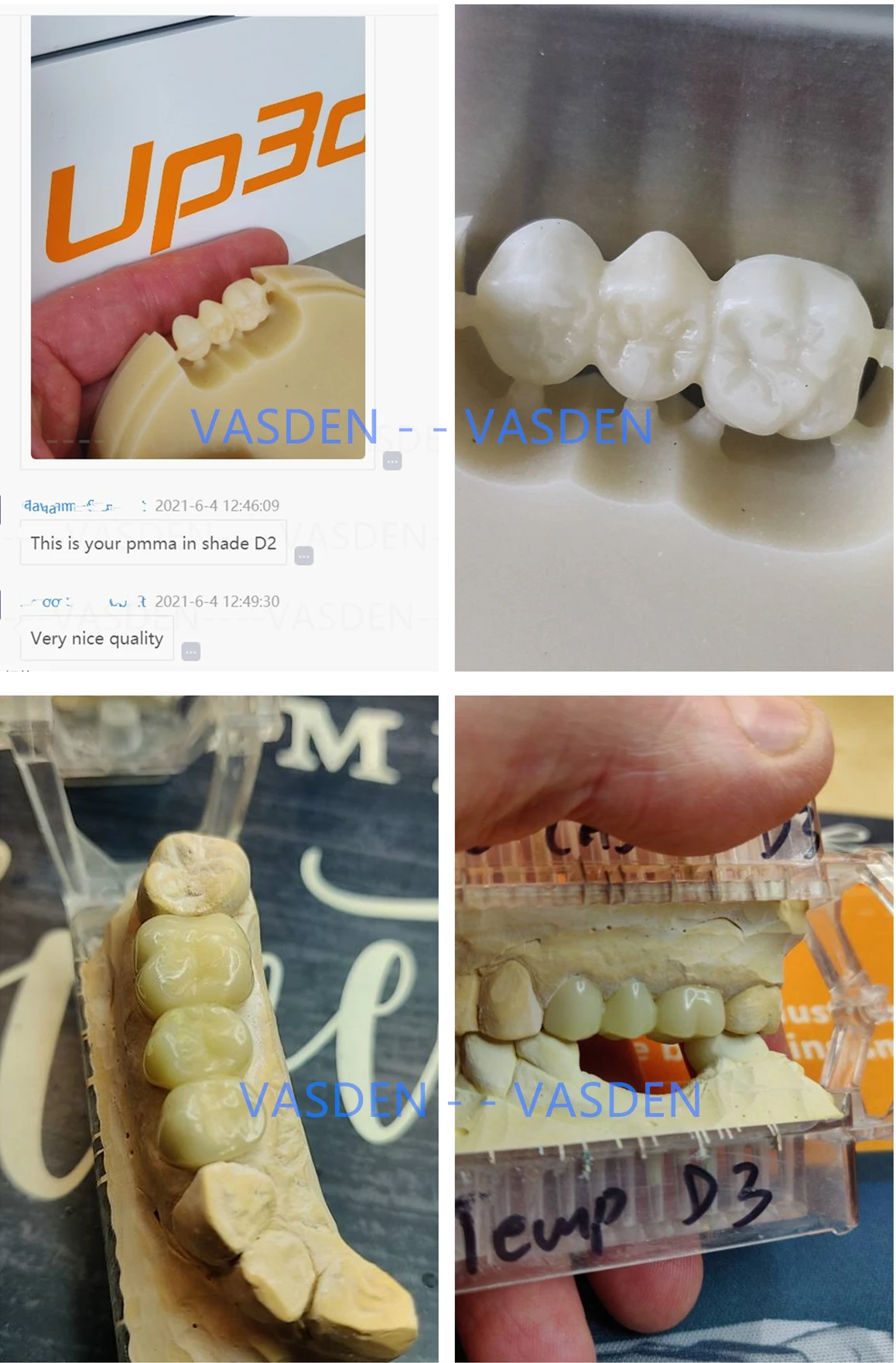 5pieces 98*14mm Clear Monolayer Dental PMMA Cad Cam Blocks PMMA Disc Dental Materials For Temporary Crown