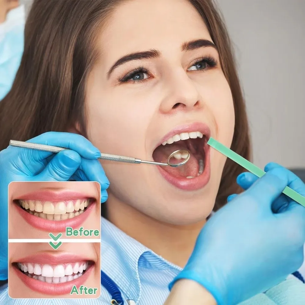 Portable Dental Polishing Strips Multifunctional 20/30/50um Tooth Finishing Strip Tooth Interdental Sanding Surface