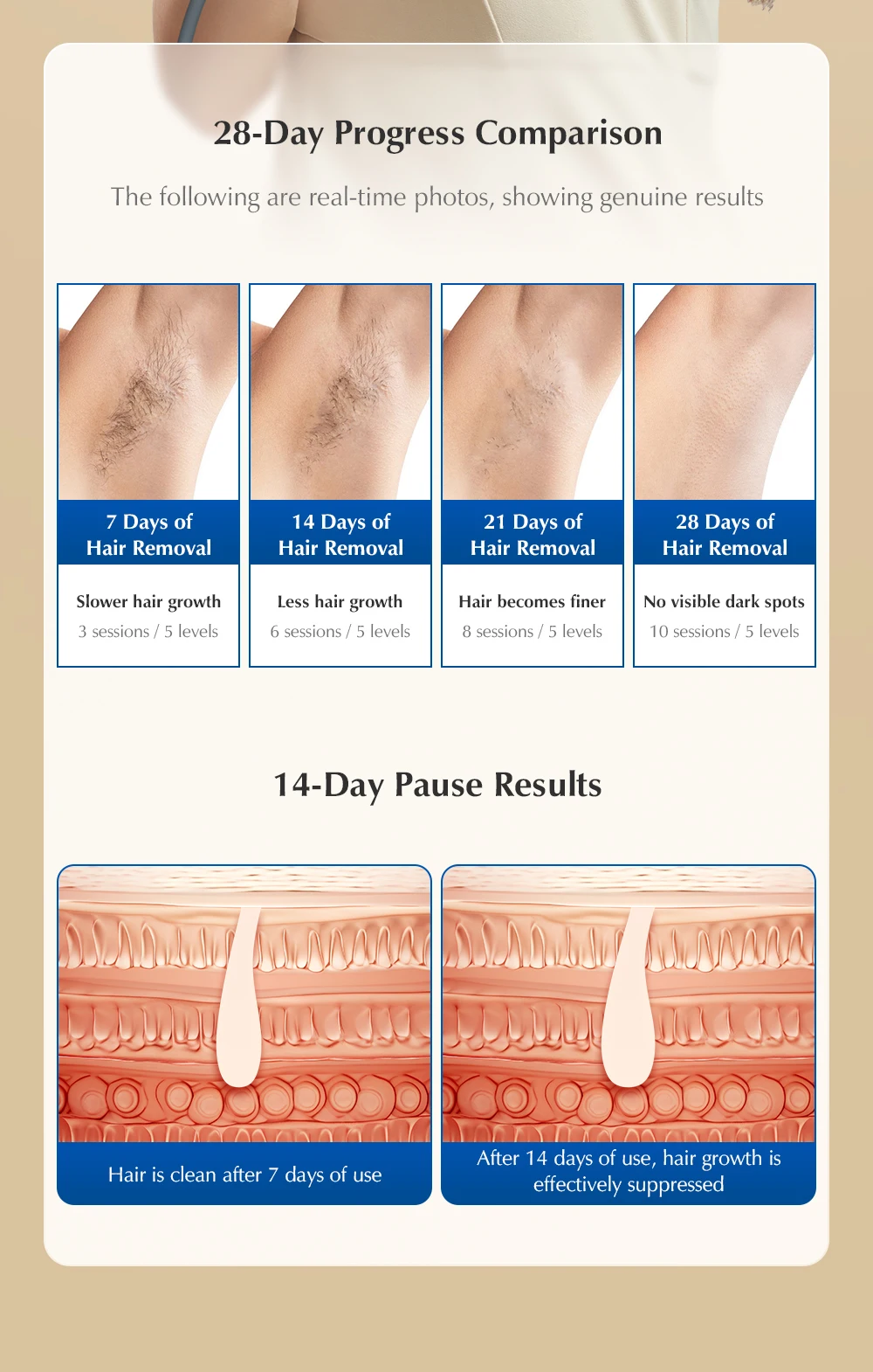 KBT36 Hair Removal IPL Laser Epilator ICE Cold 999999 Flashes Automatic Home Use Remover For Women Men Body Depilador a laser