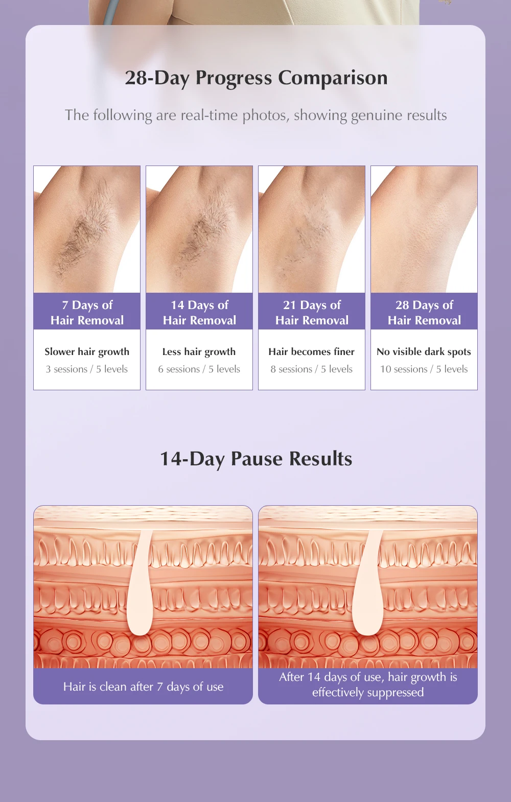 KBT36 Hair Removal IPL Laser Epilator ICE Cold 999999 Flashes Automatic Home Use Remover For Women Men Body Depilador a laser