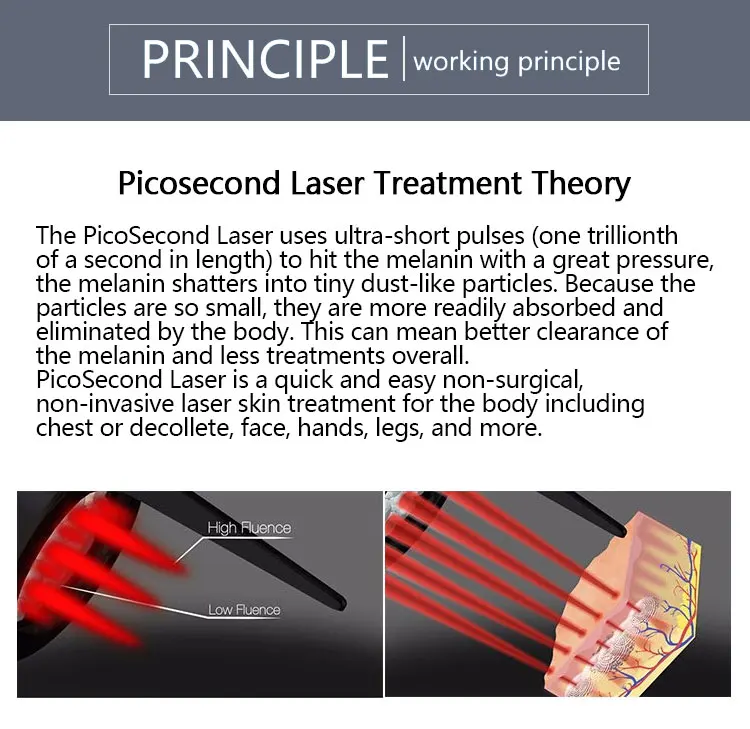 Factory Direct Sales M22 Photon Skin Rejuvenation OPT IPL Vascular Acne Removal Nd Yag Tattoo Remove Hair Removal Machine