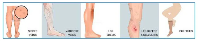 Compression Stockings Men Women 20-30 MMHg Firm Support Socks Hose Varicose Veins Hosiery for Edema, Swelling, Pregnancy, Recove