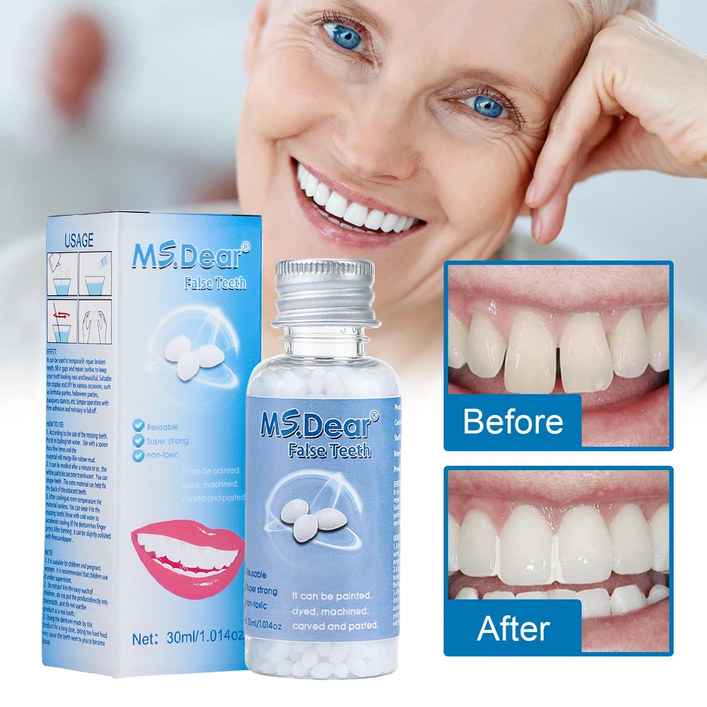 30ml Moldable False Teeth Dentures Adhesives Making Veneers Plastic Rubber Temporary Teeth Gaps Broken Repair Dental Beauty Tool