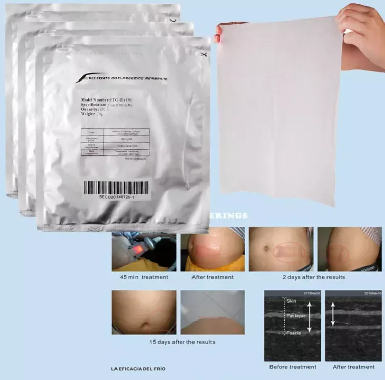 Anti-Freeze Membrane 27*30 34*42Cm Anti Freezeing Anti-Cryo Antifreeze Membrane Cool Cryo Pad Freeze Anti Freeze